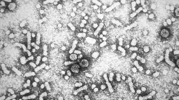 Imagen por microscopía electrónica del virus de la hepatitis B
